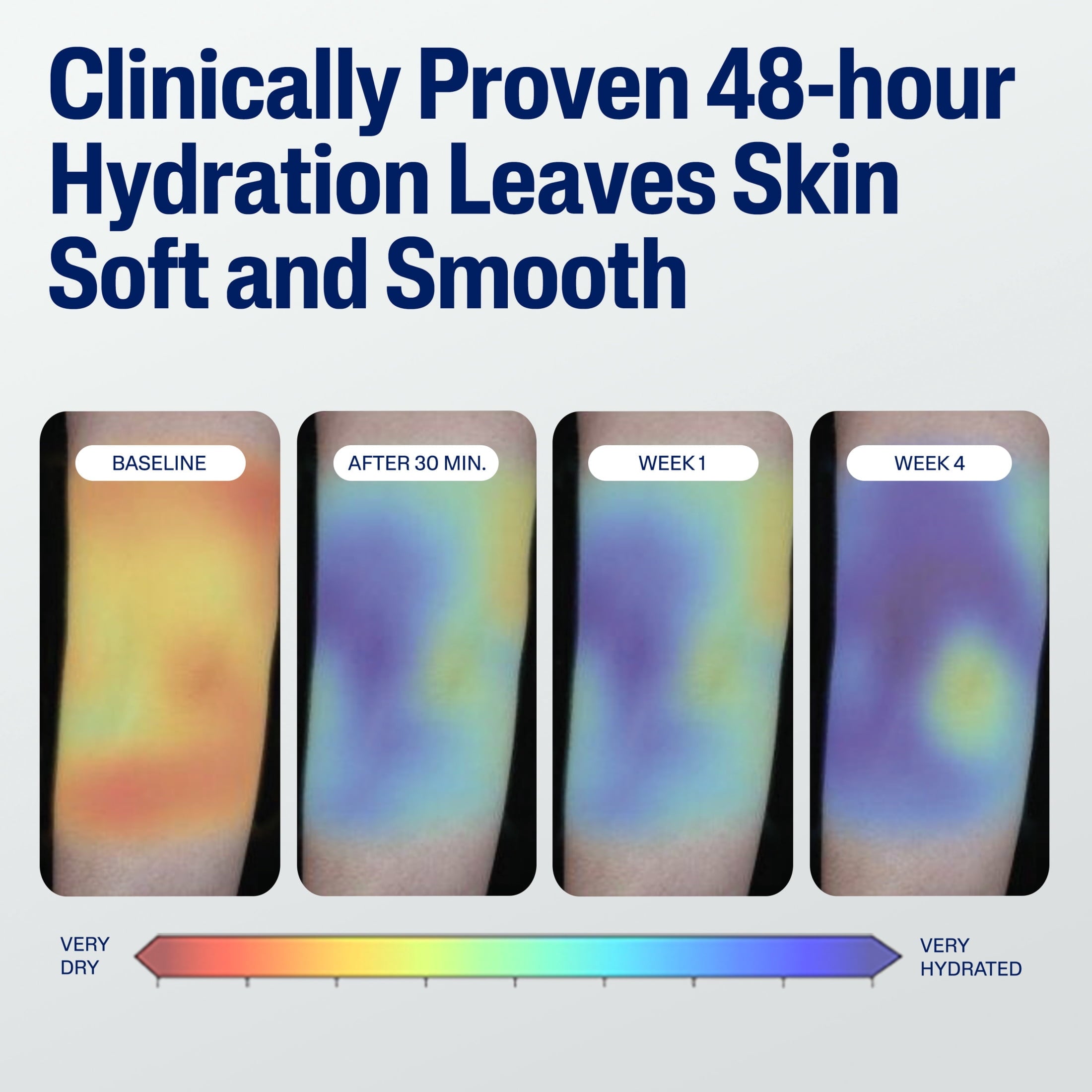 Cetaphil Moisturizing Lotion for Normal to Dry Skin, Hydrating Fragrance Free, 3.4 fl oz