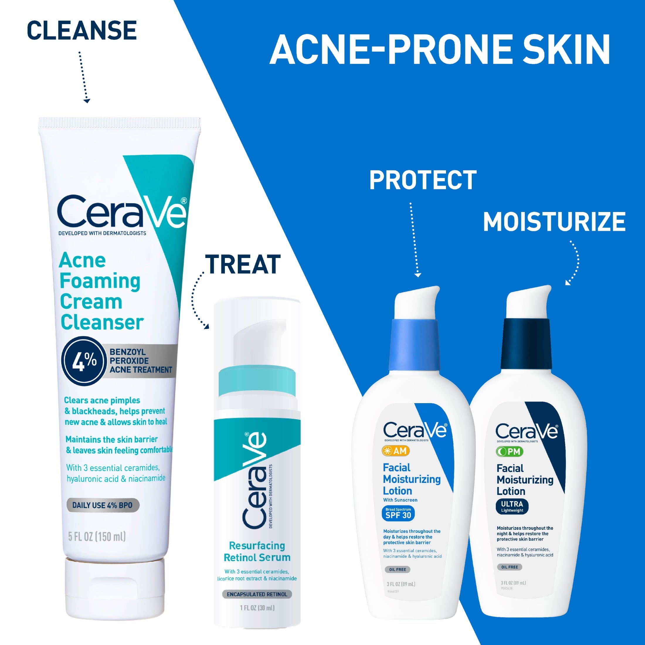 Cerave Acne Foaming Cream Cleanser with 4% Benzoyl Peroxide, Hyaluronic Acid, Niacinamide Cream-to-Foam Formula 5 fl oz