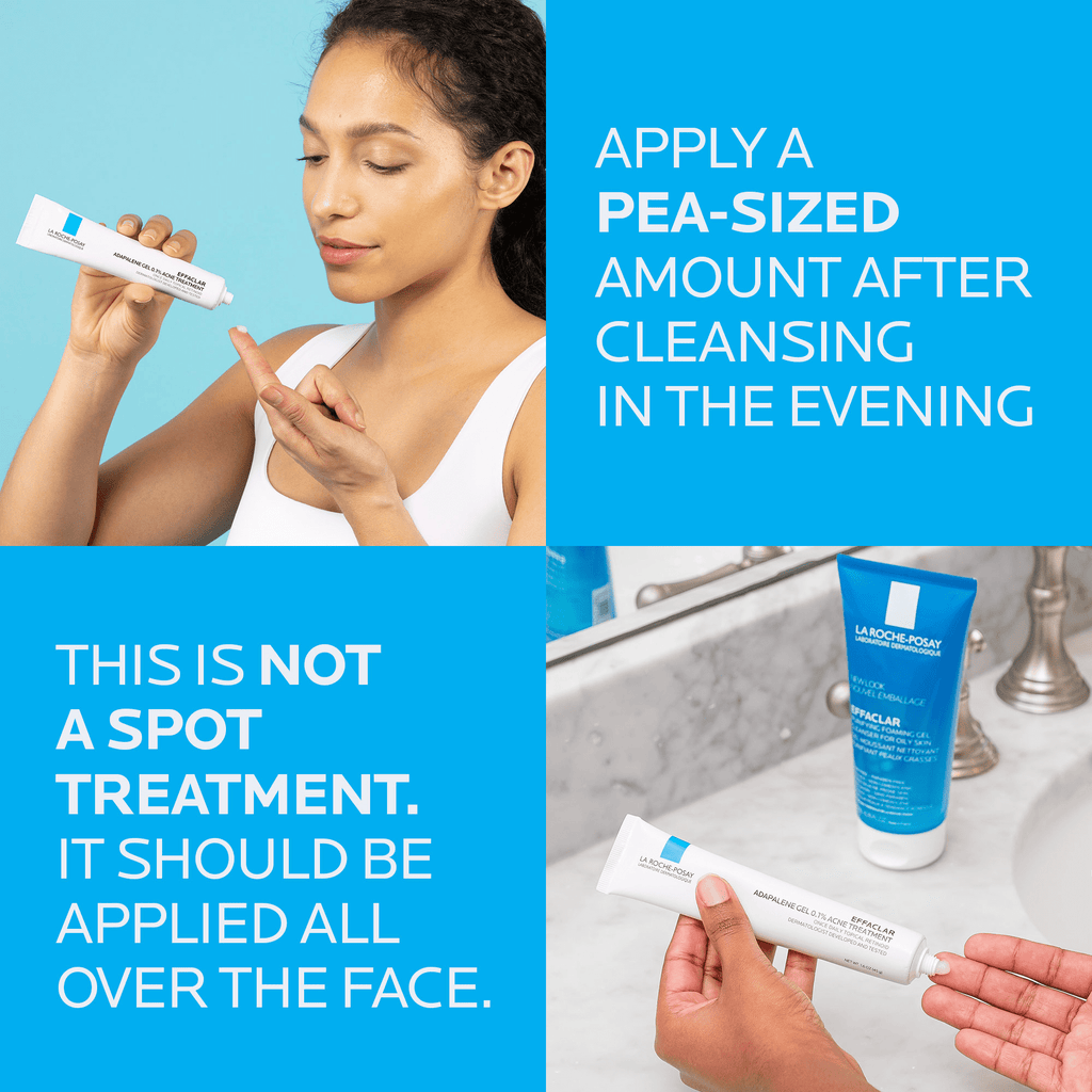 La Roche-Posay Effaclar Adapalene Gel 0.1% Acne Treatment, Retinoid Acne Cream for Oily Skin, 1.6 fl oz