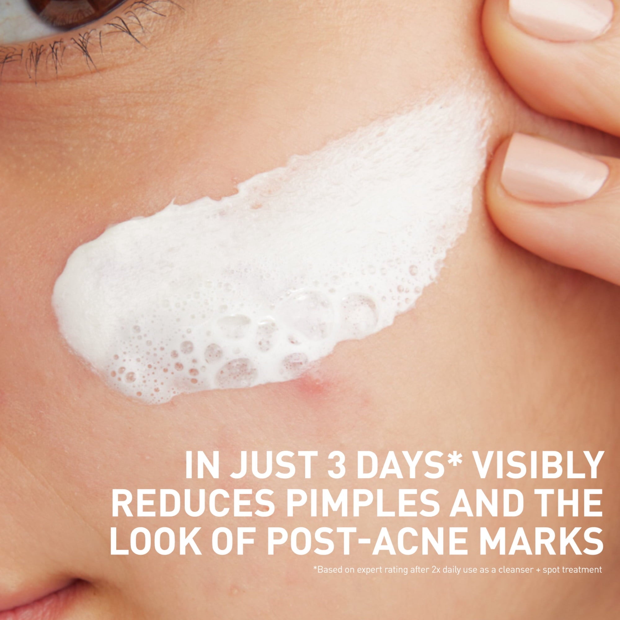 CeraVe Clay to Foam Acne Facial Cleanser, Mask & Spot Treatment for Acne Prone Skin 4 oz